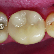ovc - dentist brochure-distributor v1_page_2_image_0003
